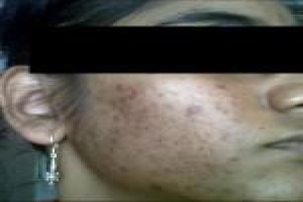 Herbal Force Skin Clinic