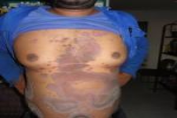 Herbal Force Skin Clinic