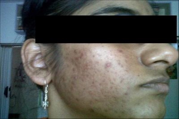 Herbal Force Skin Clinic