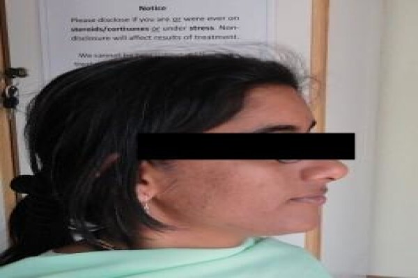 Herbal Force Skin Clinic