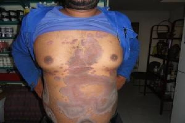 Herbal Force Skin Clinic