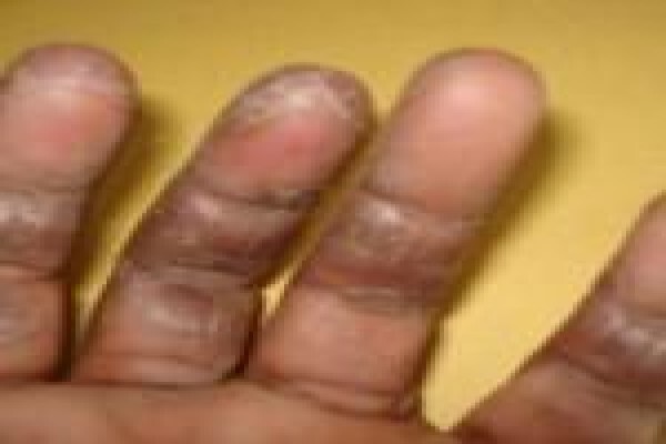 Herbal Force Skin Clinic