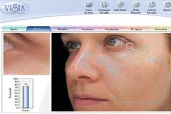 LaserClear Dermal Clinic