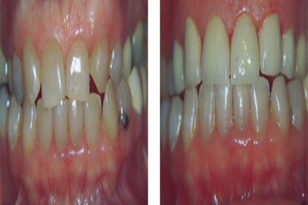 DENTAL - eTHEKWINI:MJ WINDISCH:Res