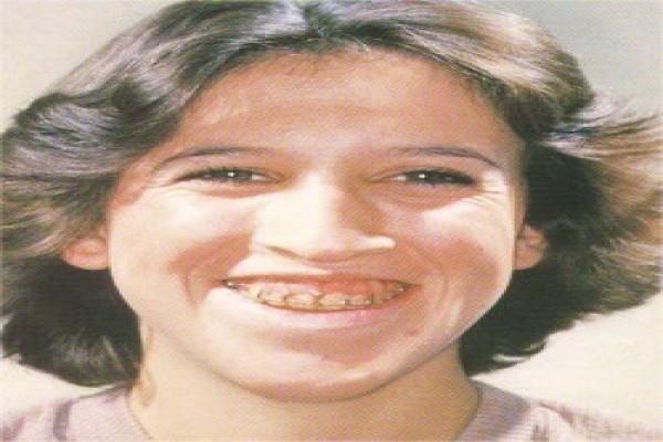 DENTAL - eTHEKWINI:MJ WINDISCH:Res