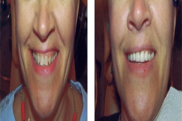 DENTAL - eTHEKWINI:MJ WINDISCH:Res