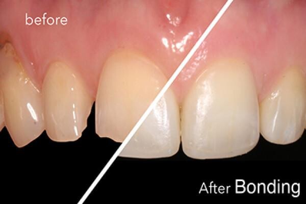 DENTAL - CAPE PENINSULA/KAAPSE SKIEREILAND:N Hayward:Res