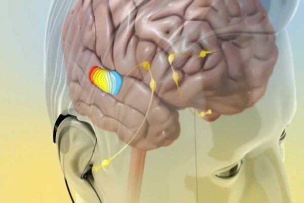 Cape Hearing Aids:Branches:Claremont