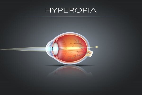 Charl Laas Optometrist