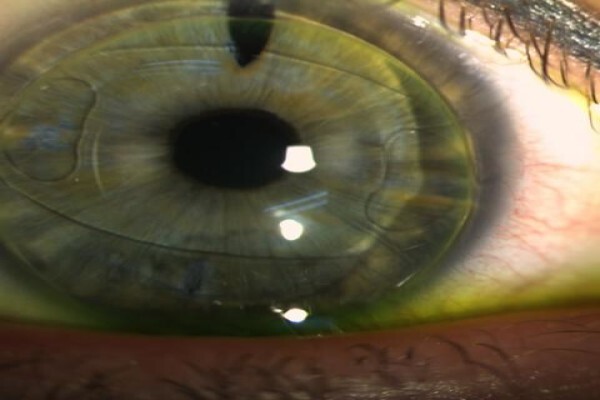 Charl Laas Optometrist