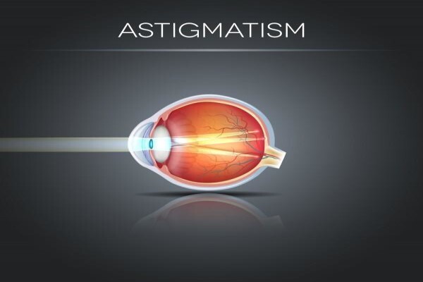 Charl Laas Optometrist