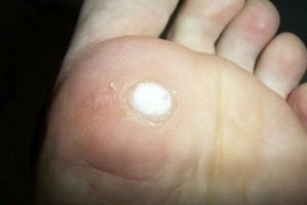 Christian Olivier Podiatrist