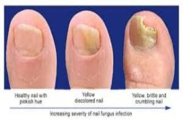 Christian Olivier Podiatrist