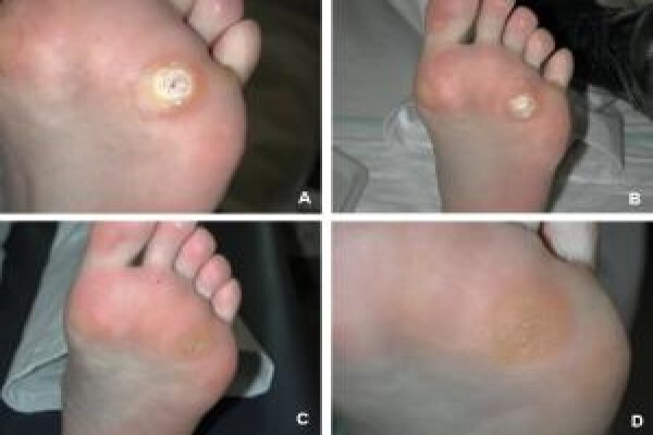 Christian Olivier Podiatrist