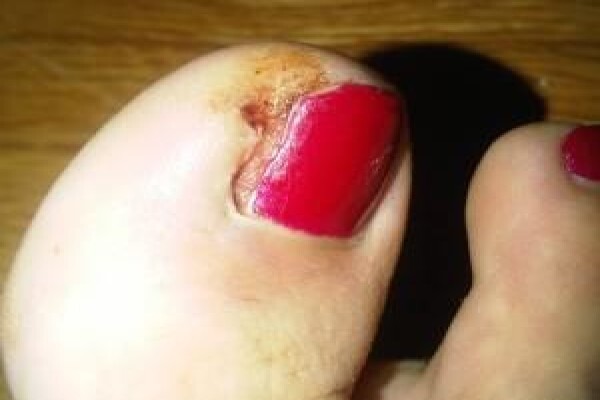 Christian Olivier Podiatrist