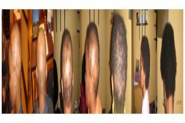 Hair Options