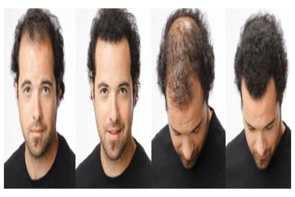 Hair Options