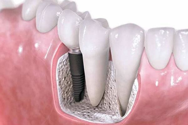Dr Riaan Kritzinger ( Dental Practice)