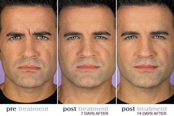 Botox Institute Sandton