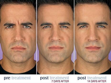 Botox Institute Sandton