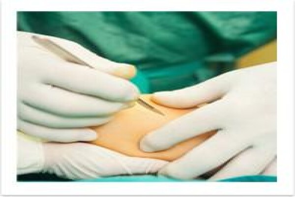 Dermatologist - Dr Imraan Jhetam