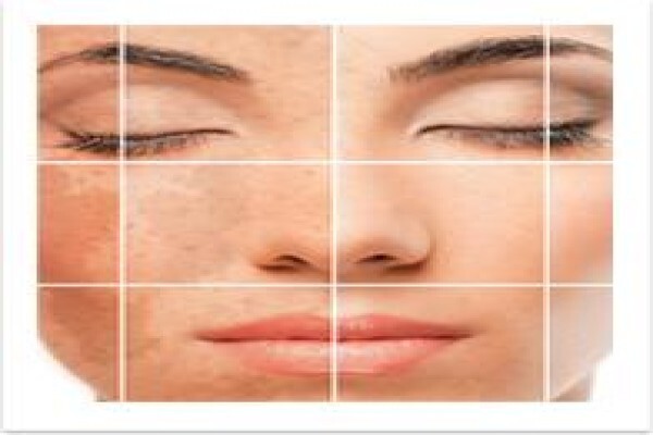 Dermatologist - Dr Imraan Jhetam