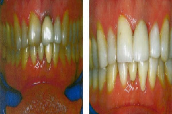 DENTAL - DURBAN:MJ WINDISCH:Res