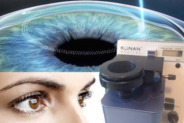 Gauteng Cornea And Eyebank