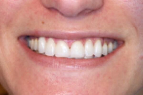 Aesthetic Dentist Johannesburg