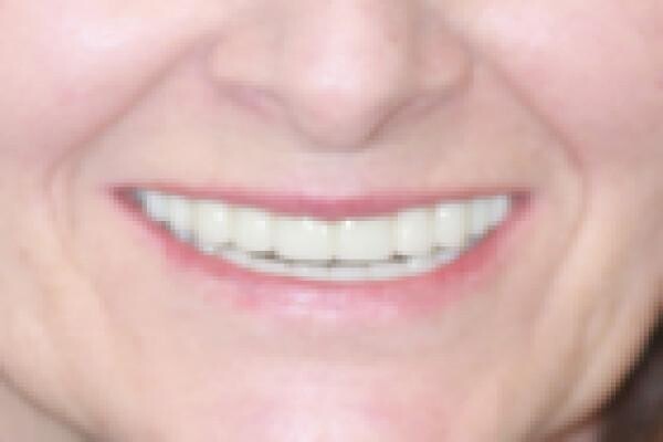 Aesthetic Dentist Johannesburg