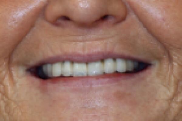Aesthetic Dentist Johannesburg