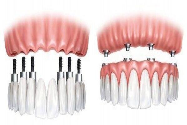 Aesthetic Dentist Johannesburg