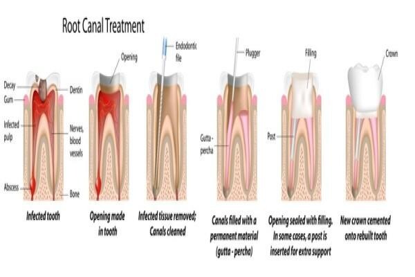 Aesthetic Dentist Johannesburg