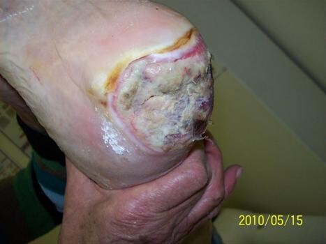 Wound And Stoma Care (Pty) Ltd