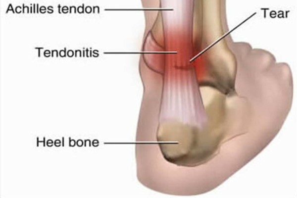 Greg Robinson Podiatrist