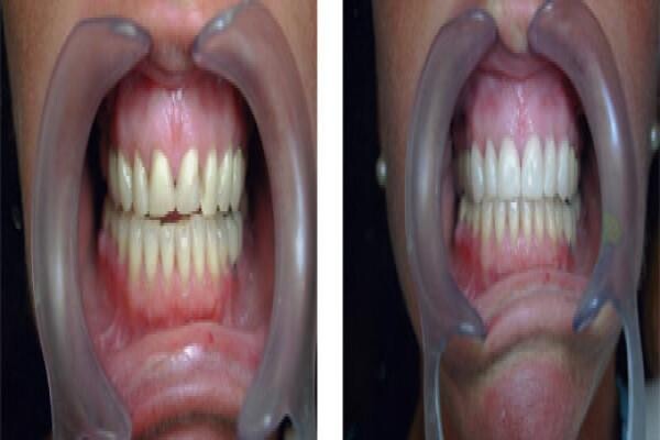 DENTAL - DURBAN:MJ WINDISCH:Res