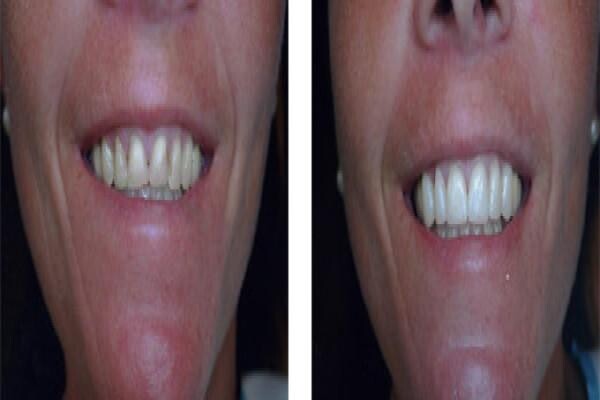 DENTAL - DURBAN:MJ WINDISCH:Res