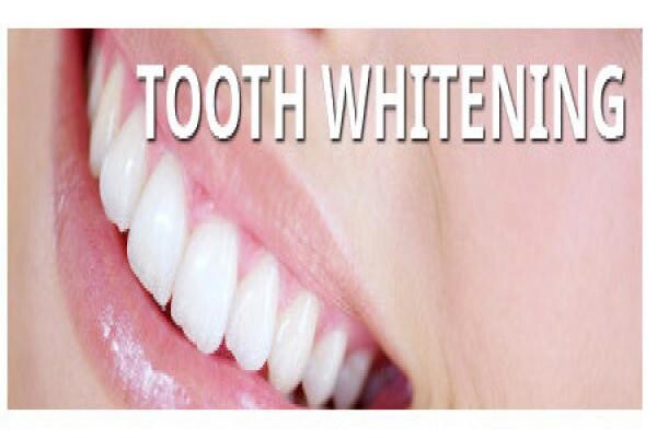 DENTAL - DURBAN:MJ WINDISCH:Res