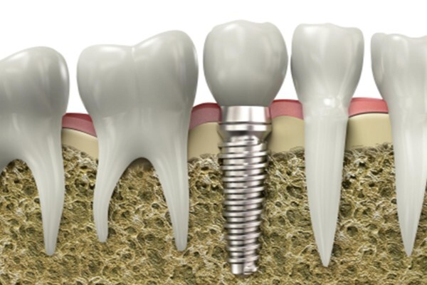 Molteno Dental Practice