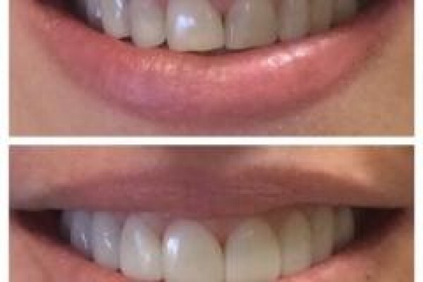 Dental Connection