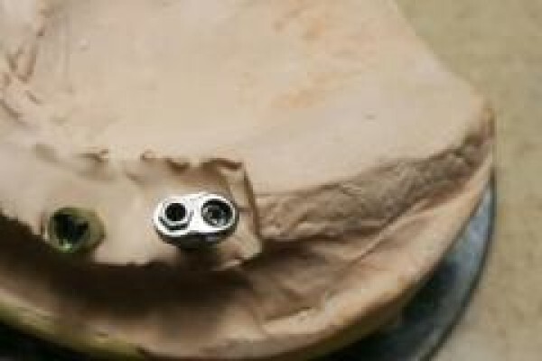 Dental Connection