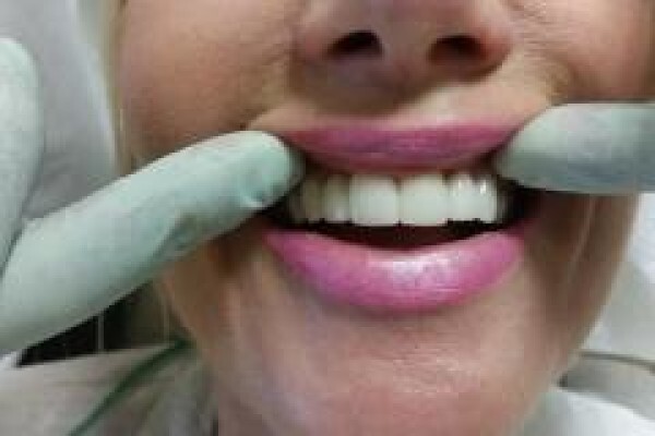 Dental Connection
