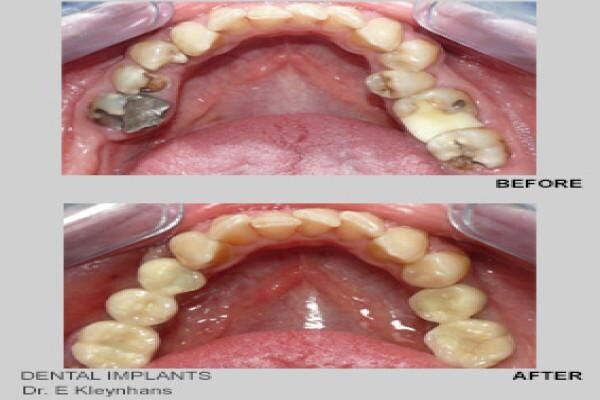 Emergency Dentist