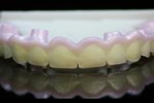 Metal Free Dental