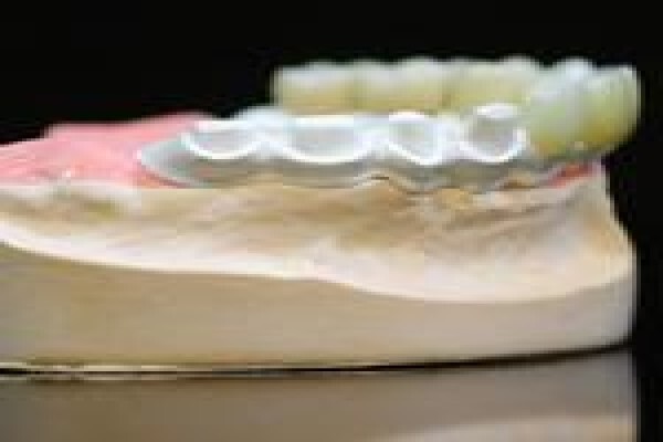 Metal Free Dental