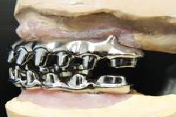 Metal Free Dental