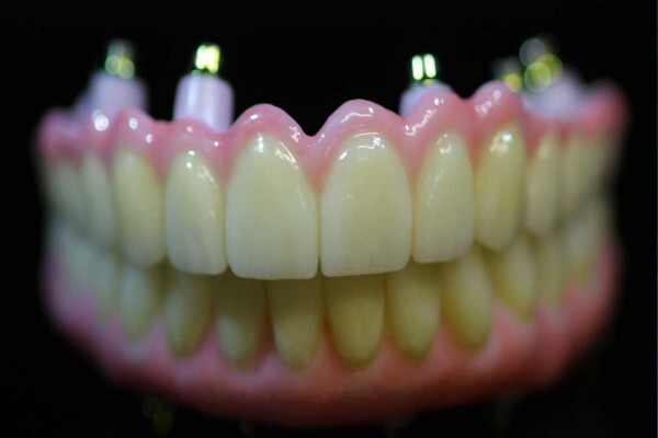Metal Free Dental