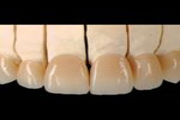 Metal Free Dental