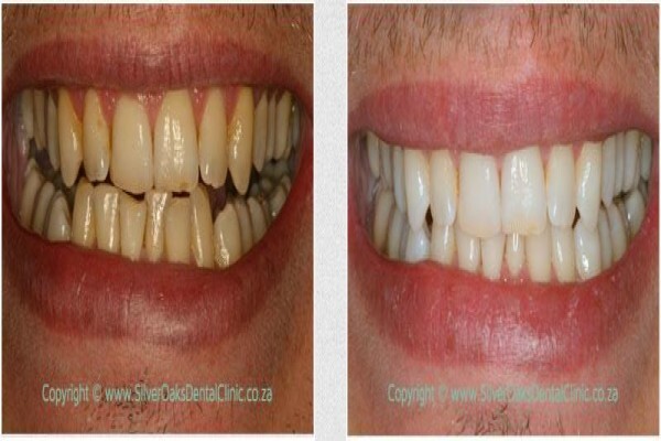 Silver Oaks Dental Clinic