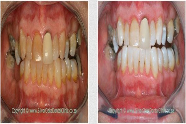 Silver Oaks Dental Clinic